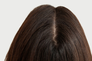 Young woman with dandruff problem on white background, closeup