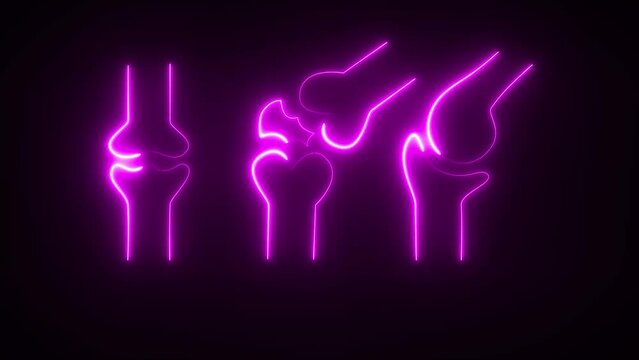 This isa synovial joint. This joint is consisted of femur and tibia. It has synovial cavity which contains synovial fluid.