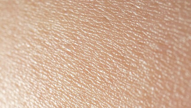 Skin texture is shaped by pore size, elasticity, and firmness. Clogged pores lead to unevenness, while aging reduces elasticity, resulting in sagging and less smooth skin. Hyperpigmentation concept. 
