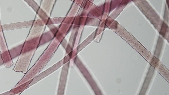 Hair under microscope. Structure of hair, consisting of keratin cells that form outer layer called cuticle, medulla in core and cortex, which forms main part of the hair. 400x times magnification
