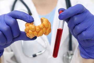 Endocrinologist showing thyroid gland model and blood sample in test tube, closeup