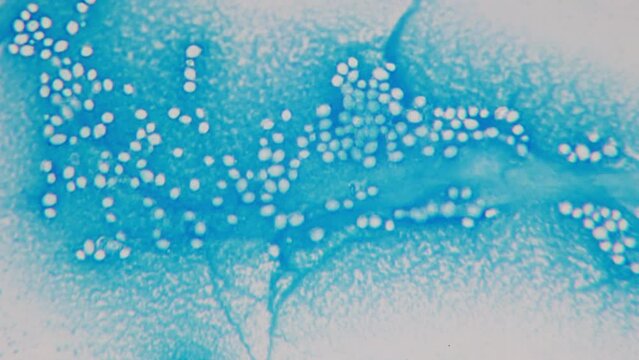 Production of Ethanol (C2H5OH). Main metabolic product of yeast bacteria of the genus Saccharomyces. Laboratory scientific specimen under microscope. Energy production, waste treatment and agriculture