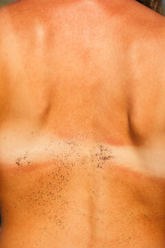 Woman's naked back in the sun