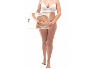 The girl stretches the skin on the leg and on the stomach, showing fat deposits. Treatment and...