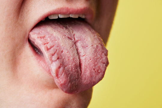 this is what your tongue says about you