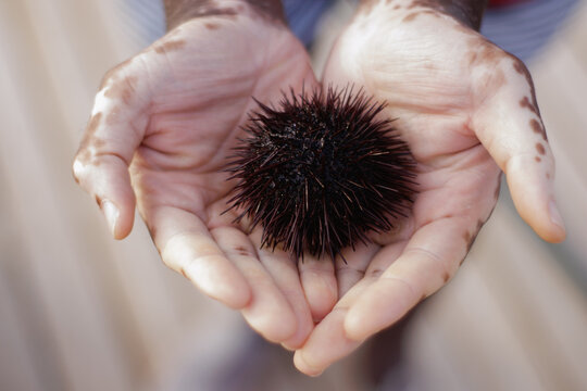 sea ​​urchin