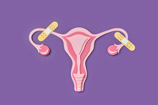 Paper made female uterus with adhesive plasters on fallopian tubes