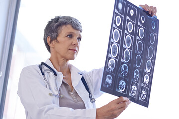 Woman, mature doctor and review xray for planning medical treatment, surgery and healthcare at...