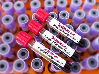 Blood sample for Testosterone Test (Pooled 3 sample). Medical check up test tube with biological...