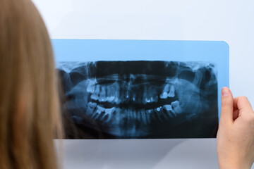 Dentysta trzyma w dłoni zdjęcie rentgenowskie pantomogram zębów  - obrazy, fototapety, plakaty