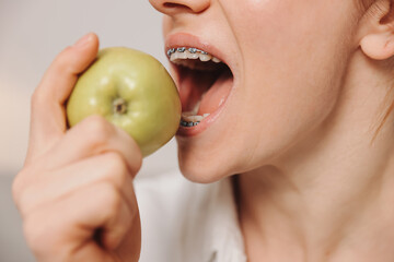 Portrait of mature woman with braces on teeth eating green apple