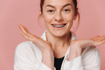 Modern happy woman showing smile with braces on pink background