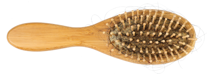 Alopecia hair loss problem, health care concept. Closeup dirty hairbrush with a bunch of loss long hair inside, isolated on white background.