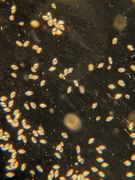 photo of date palm pollen powder under the microscope