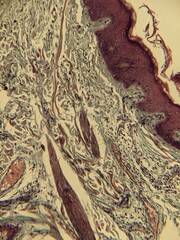 Fototapeta premium microscope slide contain section of human tissue