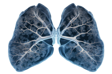 A lung radiograph of a non-smoker shows normal-appearing lungs. Without the gender of cancer or symptoms that promote lung cancer Isolated on a transparent background.