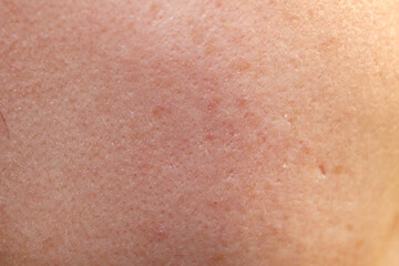 Fototapeta premium Texture of natural female skin close-up. Stock photo of the body in the best quality.