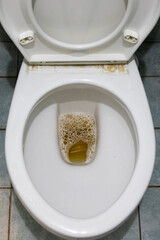 Yellowish urine with bubble in toilet bowl may indicate health problem