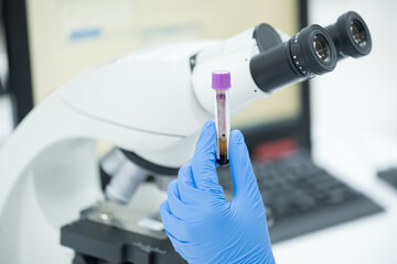 Selective focus technician blue glove hand holding blood test tube for scientist diagnosis and...