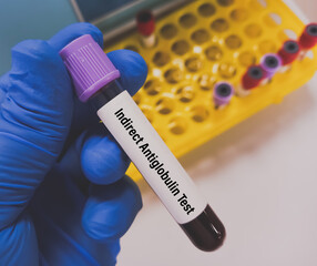 Blood sample for Indirect antiglobulin test (IAT), diagnosis of hemolytic anemia or hemolytic...