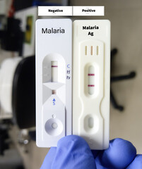 Malarial Parasite(MP) Test, Medical check up test, show positive and negative result on rapid test kit.