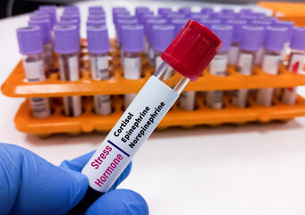 Blood sample for Stress hormone test. Cortisol, epinephrine (adrenaline) and norepinephrine are...