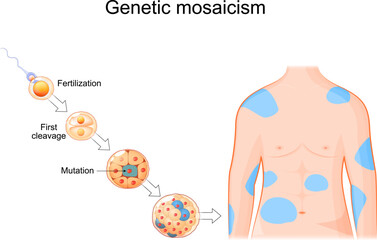 Genetic mosaicism. Somatic mutation.