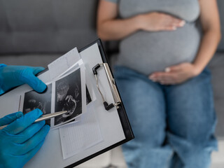 Gynecologist looks at an ultrasound of a pregnant woman. 