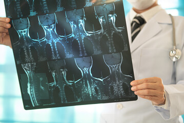 Orthopedic surgeons or doctor surgery looking cervical spine x-ray images for diagnose orthopedics,...
