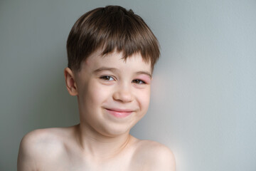 Portrait of happy beautiful joyful little 6 year boy with red swollen eye isolated on grey...