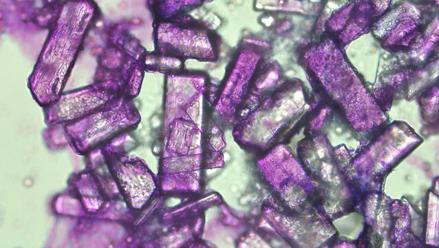 Triple Phosphate Crystals or struvite in cat urine, microscope view X400