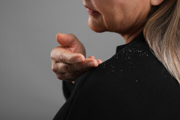Woman brushing dandruff off her sweater on gray background, closeup