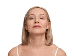 Woman with perfect skin after cosmetic treatment on white background. Lifting arrows on her neck and face - 761704917