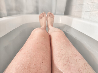 Close-Up of Varicose Veins on a Leg in the Bathtub. Leg with varicose veins while submerged in a...
