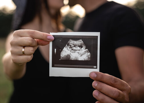 Parents holding sonogram picture of unborn baby	