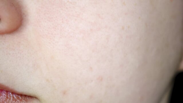 Before and After Skin Care Treatment. A Line Swipes Across the Screen Revealing Clear and Healthy Skin. Skin Care Success Visualisation.