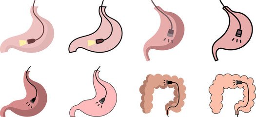 내시경