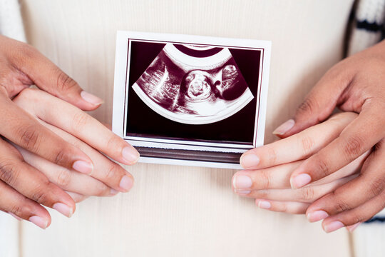 Expectant parents holding an ultrasound picture, showing their unborn baby, creating a cherished memory.
