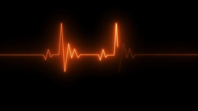 Neon Electrocardiogram Heartbeat Pulse Heart attack monitoring Medical Patient Treatment Display Background Loop