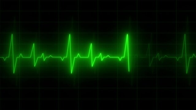 Neon Electrocardiogram Heartbeat Pulse Heart attack monitoring Medical Patient Treatment Display Background Loop.
