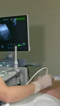 Amniotic fluid test. Amniocentesis. Ultrasound examination of the fetus of a pregnant woman. Ultrasonic scanner. Vertical video.