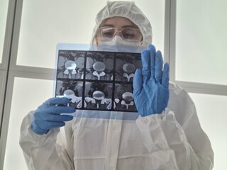 Doctor in protective suit and mask is holding an X-ray
