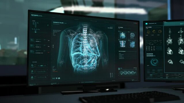 Identifying the illness using the x-ray examination of the chest. X-ray examination tech is searching for the illness in the heart. X-ray examination system finds dangerous cardiac ischemia illness.