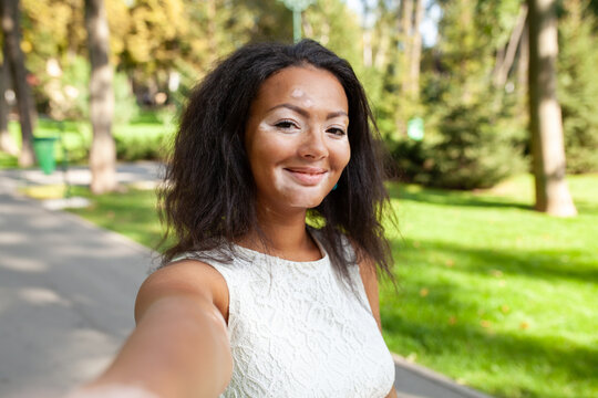 Happy woman with vitiligo pigmentation skin problem taking selfie in park. Portrait of black african American lady with dark hair spending leisure time in park during weekend.