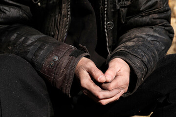 Poor homeless man with dirty hands outdoors, closeup