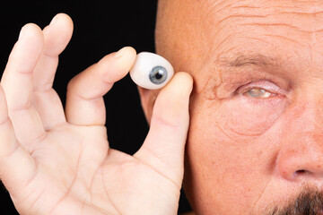 Cosmetic prosthesis of the human eye against the background of a male face with the consequences of...