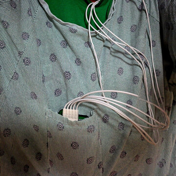 View of a person with a heart monitor device in the pocket of their hospital gown.