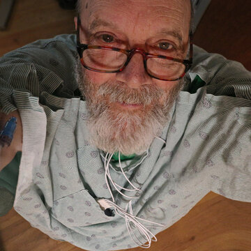 Man Senior, in a hospital robe, looking up at the camera. Wearing a heart monitor device. Beard and glasses.