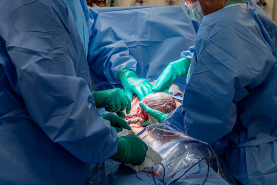 Nascimento de beb&ecirc; rec&eacute;m-nascido no momento do parto