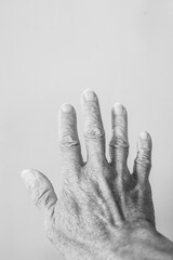 Body parts of elderly people who have symptoms of muscle and joint abnormalities, pain, and...